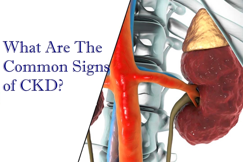 Chronic Kidney Disease