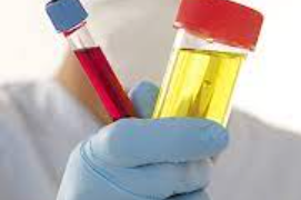UTI Treatment in Highland
