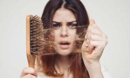 Hair Loss Causes