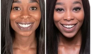 Dark Gums