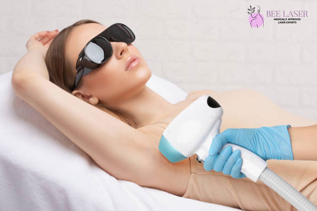 Laser Hair Removal Treatment Walsall