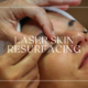 LASER SKIN RESURFACING