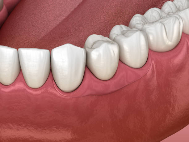 denture repair service