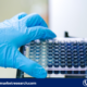 Enzyme-Linked Immunosorbent Assays (ELISAs) Market