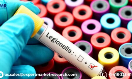 Legionella Testing Market