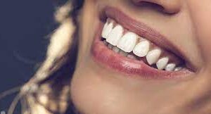 Purple Gums