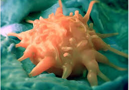 eosinophilia symptoms