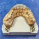 dentist arana hills
