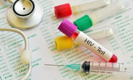 Anonymous HIV screening Singapore