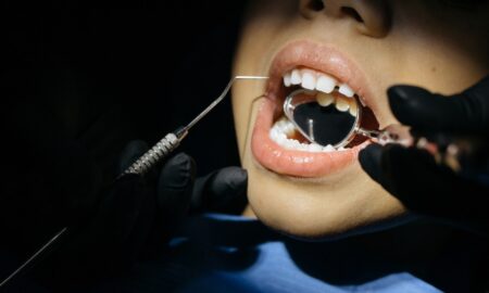 Child’s Teeth