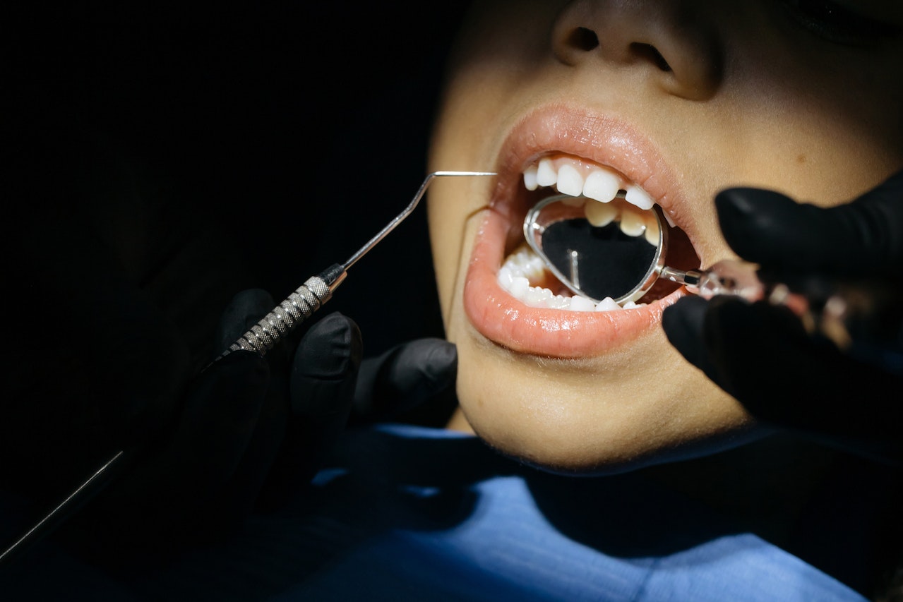 Child’s Teeth