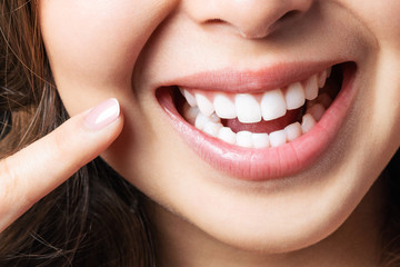 Gums Lightening