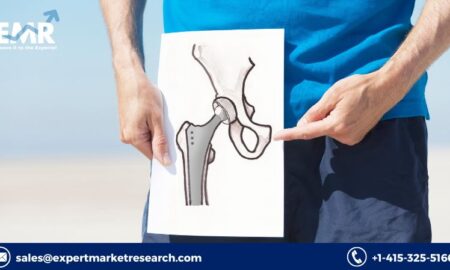 Hip Replacement Implants Market