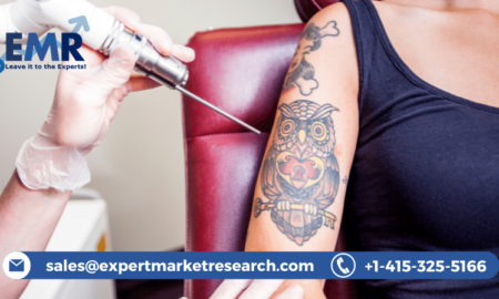 Tattoo Removal Market