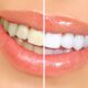 teeth whitening products wholesale